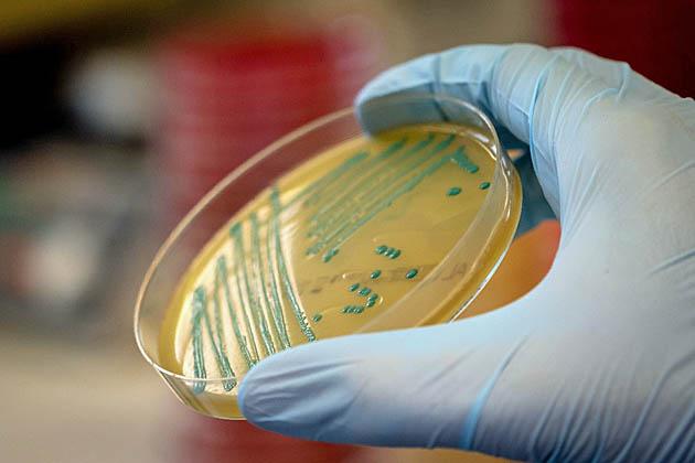 Analisi microbiologica per il controllo della Listeria monocytogenes